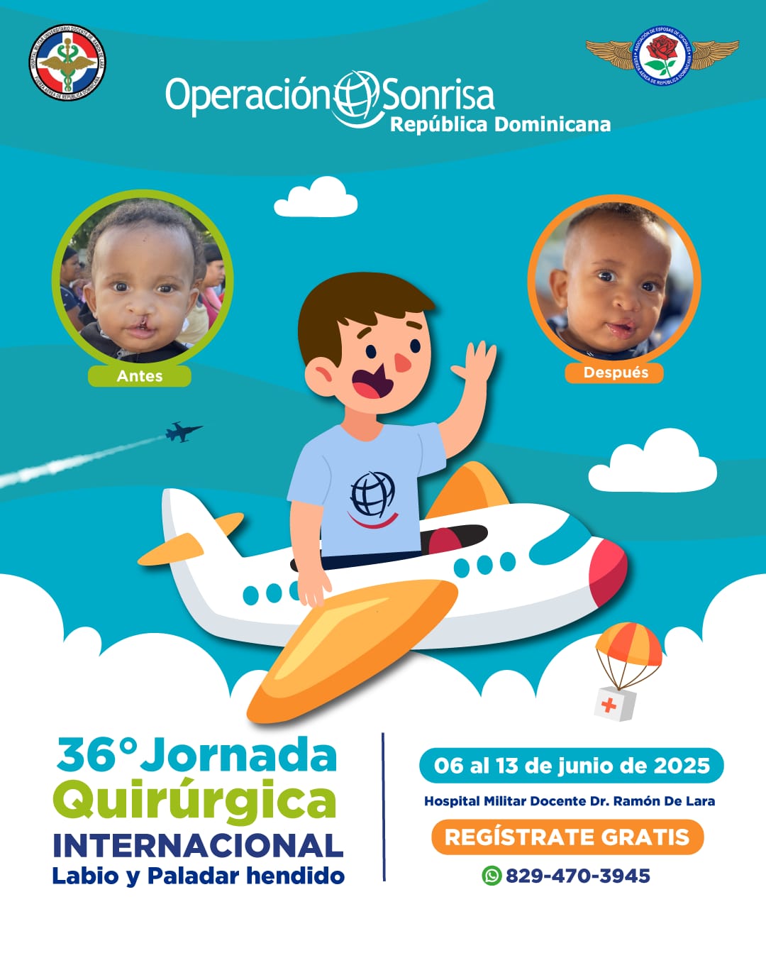 Fundación Operación Sonrisa realizará jornada quirúrgica gratuita de Labio y Paladar Hendido