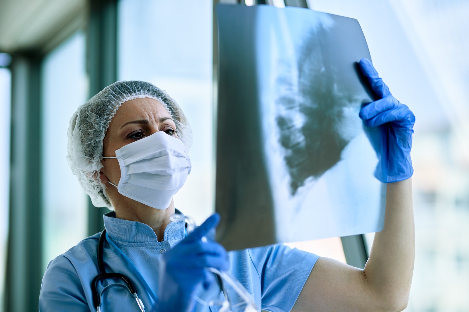 Intervención temprana es el mayor desafío en la atención de la fibrosis pulmonar idiopática